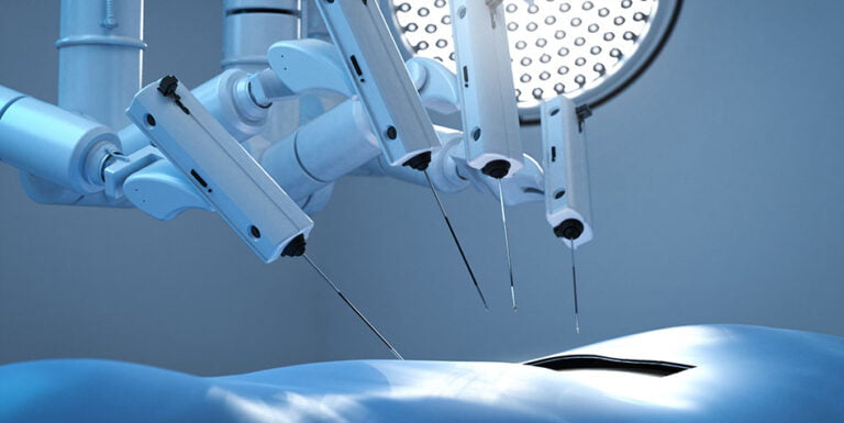 Cirurgia Robótica e Cirurgia por Vídeo: 7 diferenças entre a RATS e a VATS - cirurgia robotica