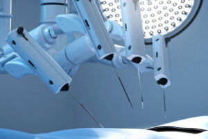 Cirurgia Robótica e Cirurgia por Vídeo: 7 diferenças entre a RATS e a VATS - cirurgia robotica e1722827134632