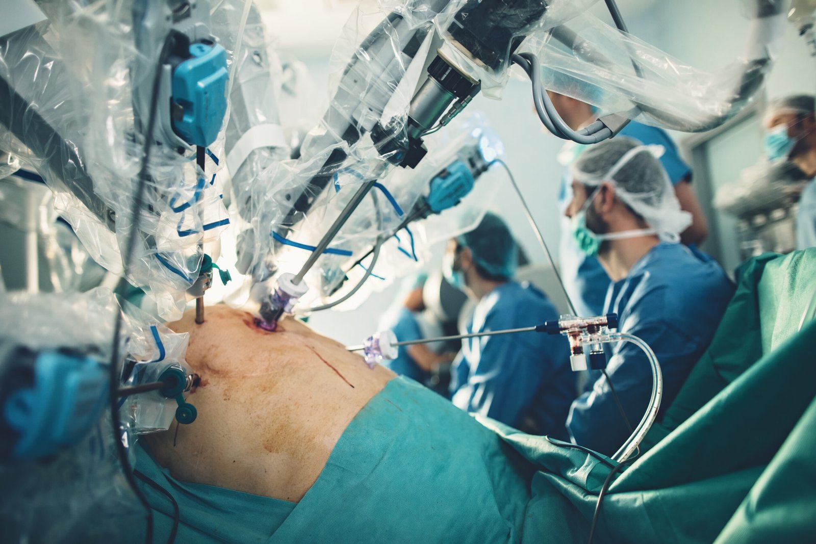 Surgical room in hospital with robotic technology equipment, machine arm surgeon in futuristic operation room. Minimal invasive surgical medical robot, urology surgery with robotic assisted surgeon Os benefícios da Cirurgia Robótica